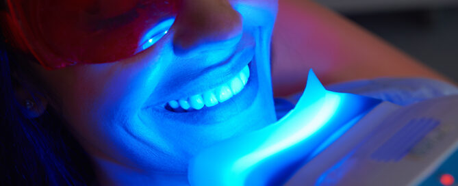 Teeth Whitening: Professional vs. At-Home Solutions