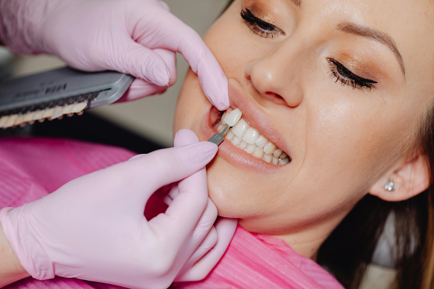 Porcelain vs Composite Veneers: Which Is Right?